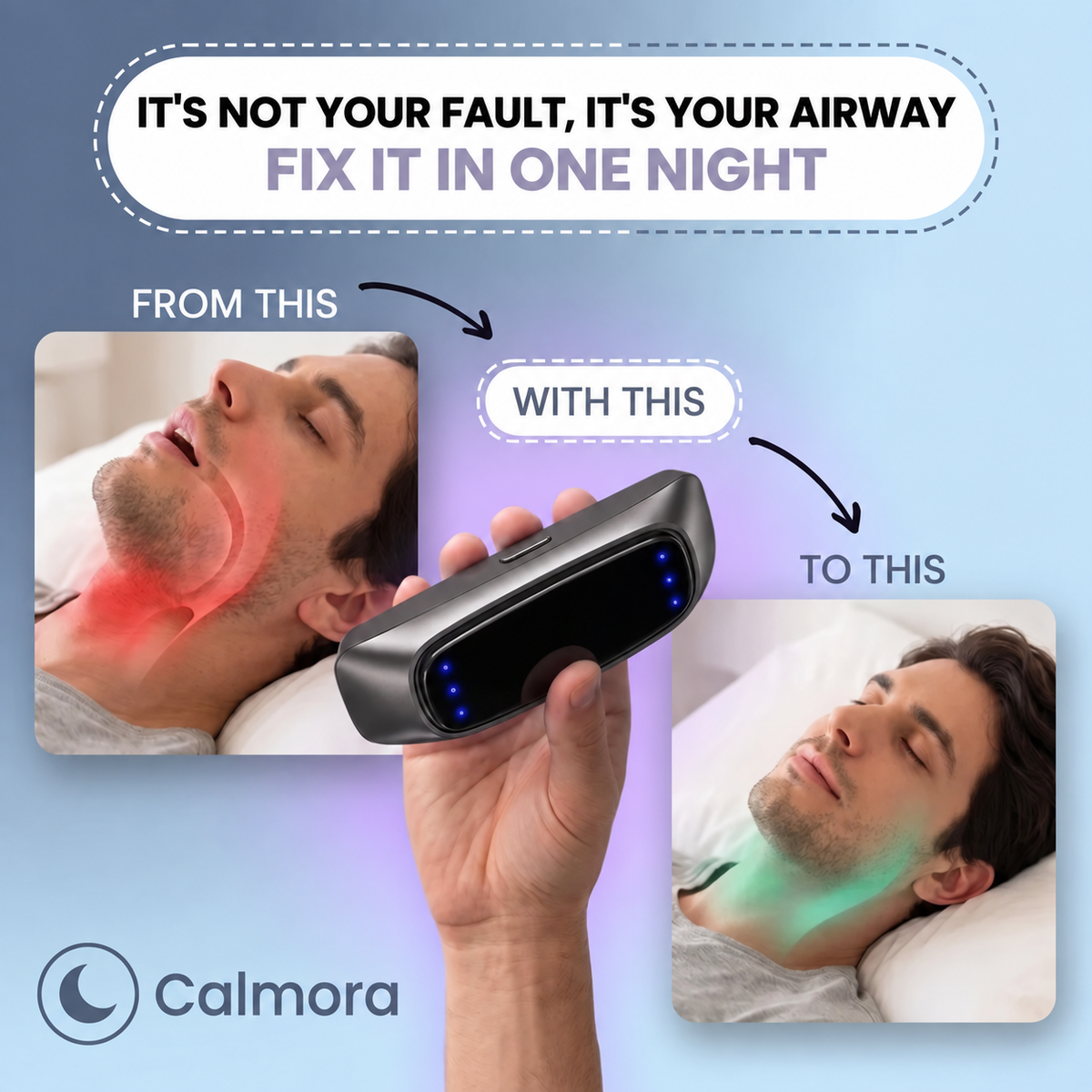 Ultimate Stop Snoring Electronic Muscle Stimulator 💤